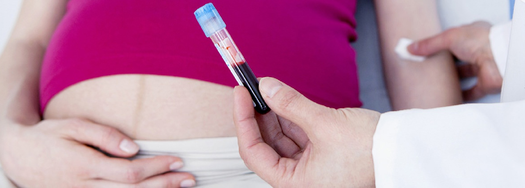 آزمایش خون مادر در غربالگری سه ماهه اول بارداری
