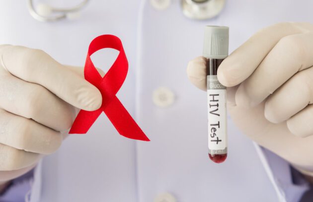 آزمایش تشخیص ایدز (HIV) چیست؟ | انواع، تفسیر