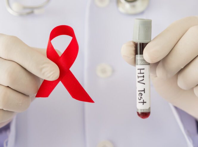 آزمایش تشخیص ایدز (HIV) چیست؟ | انواع، تفسیر