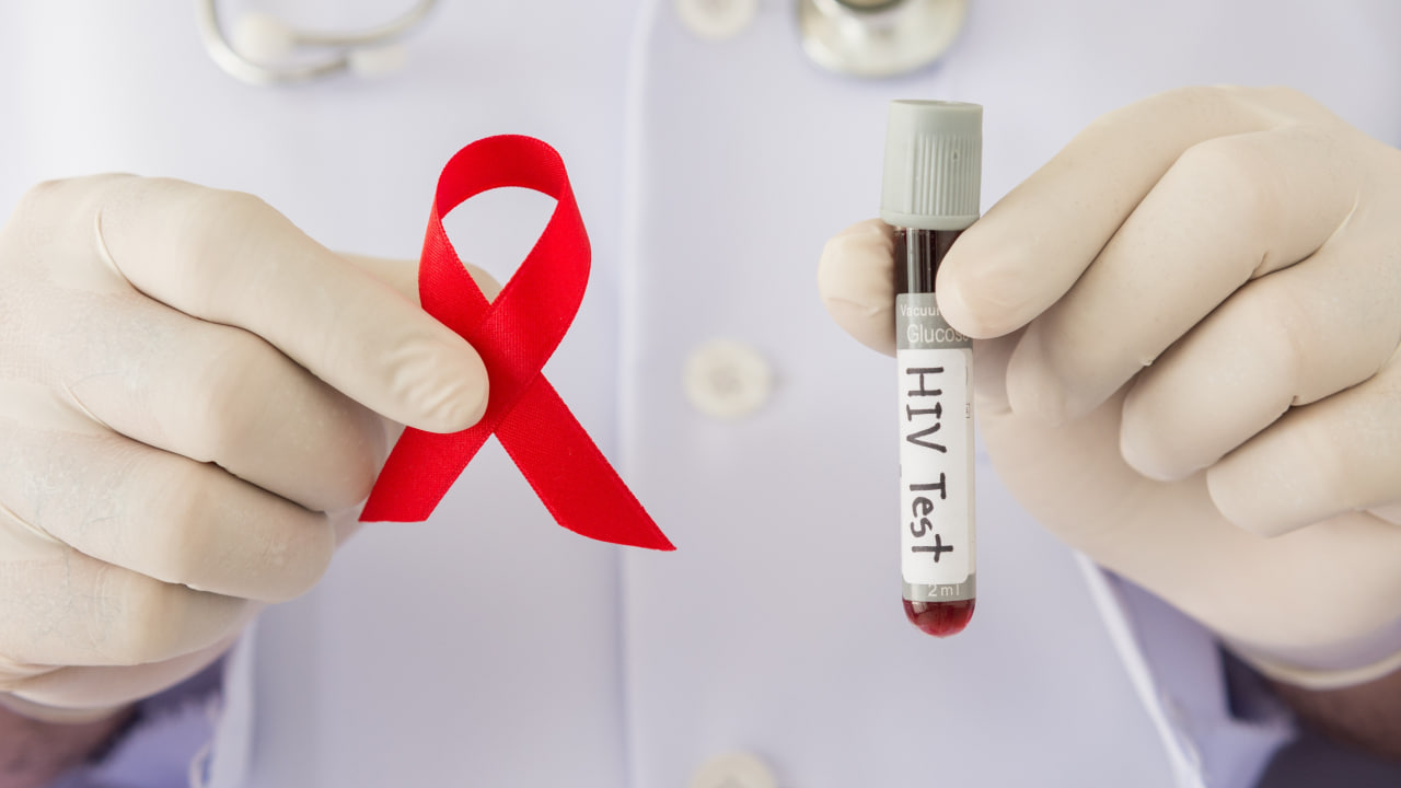 آزمایش تشخیص ایدز (HIV) چیست؟ | انواع، تفسیر