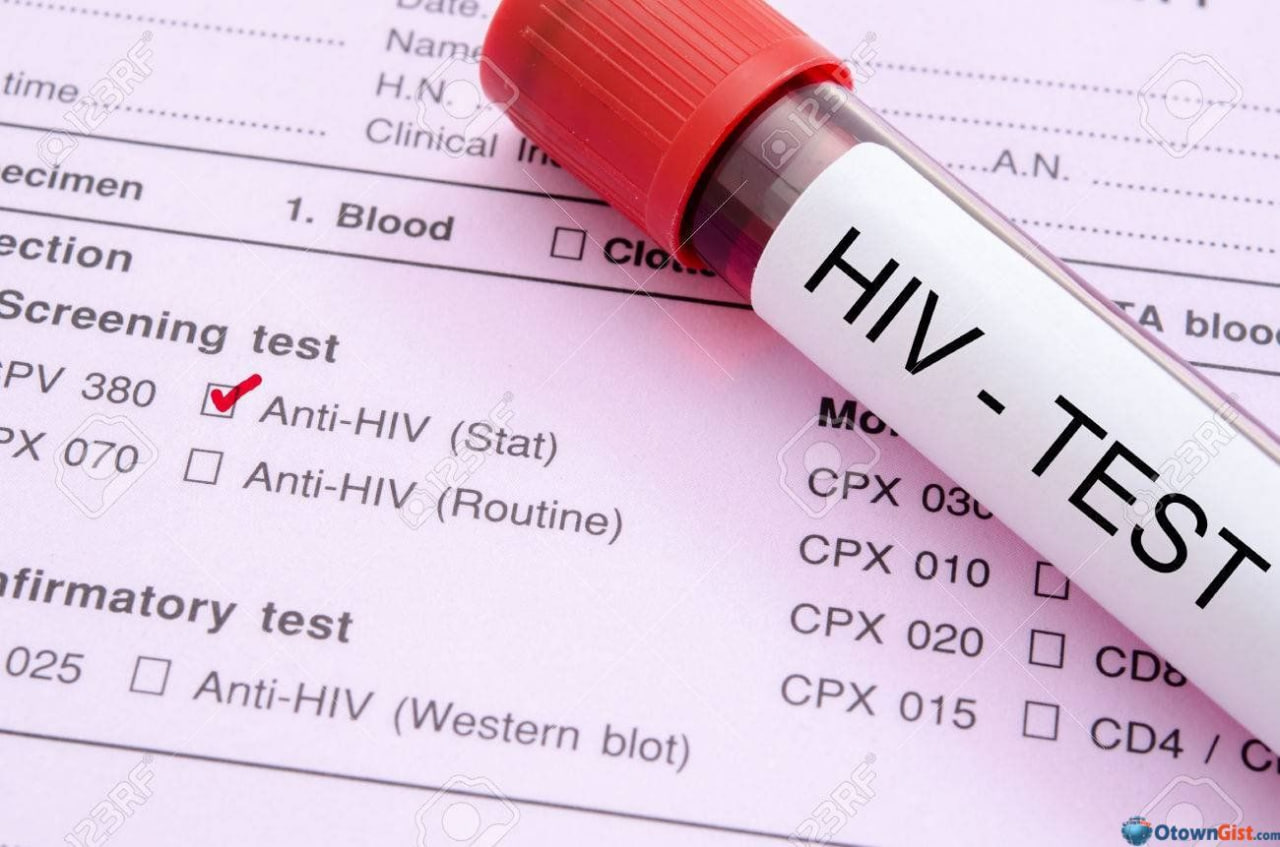 منظور از آزمایش HIV چیست؟