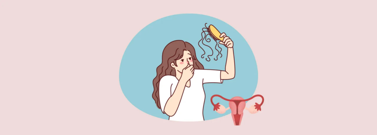 علائم شایع سندروم تخمدان پلی کیستیک