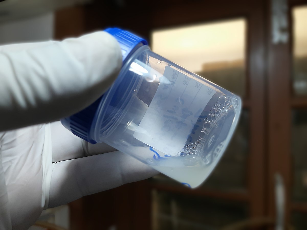 آزمایش اسپرم در آزمایشگاه چگونه انجام می‌شود؟