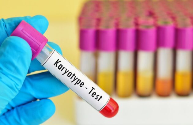 آزمایش کاریوتایپ (Karyotype) چیست؟
