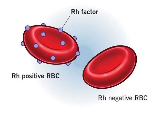 فاکتور Rh چیست و ناسازگاری Rh چه زمانی رخ می‌دهد؟