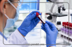 آزمایش-CRP