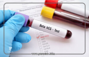 بتا-HCG